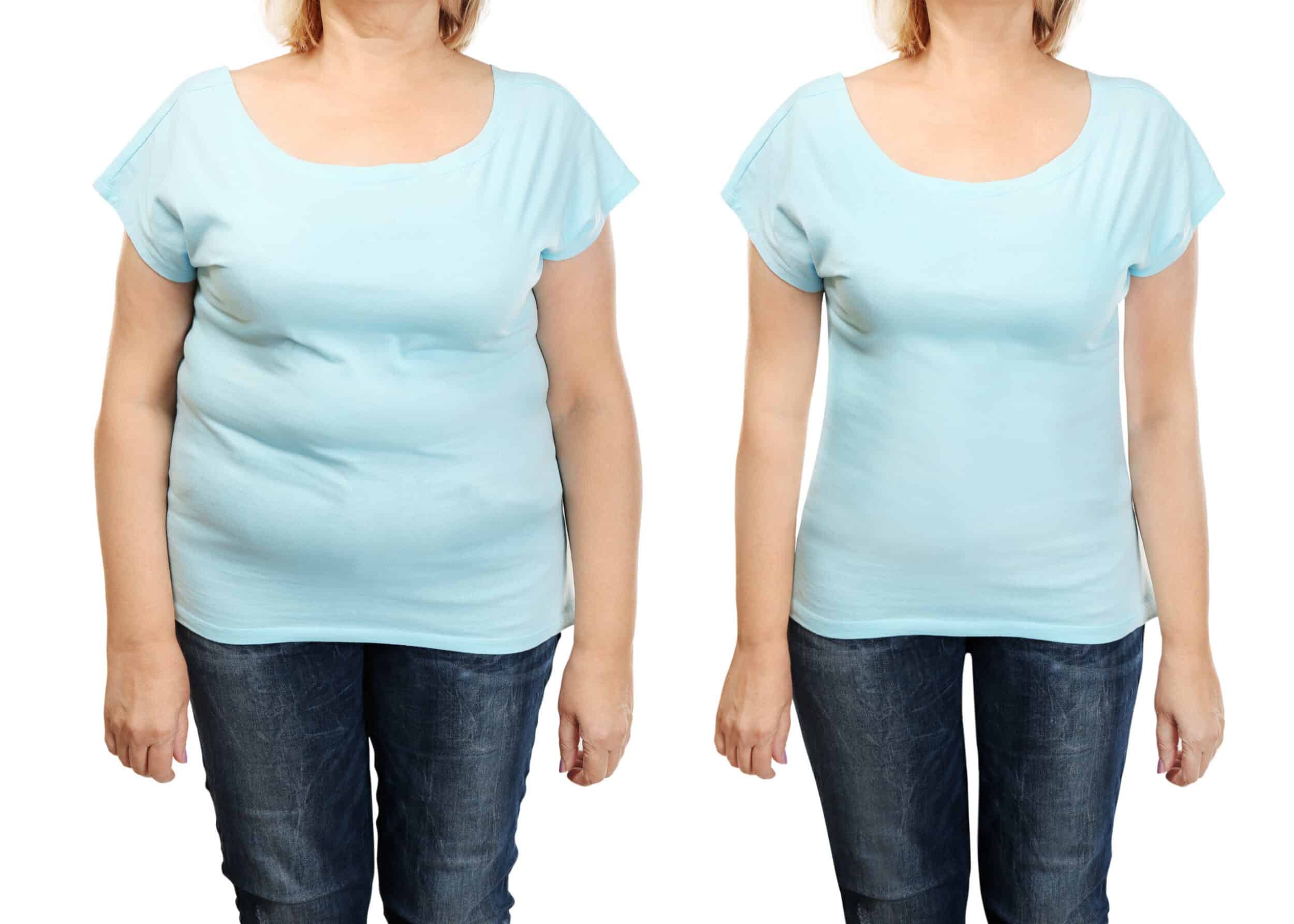 Mature,Woman's,Body,Before,And,After,Weightloss,On,White,Background.