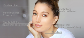 The Difference Between Botox and Dermal Fillers 646cf9f7c2c7c.png