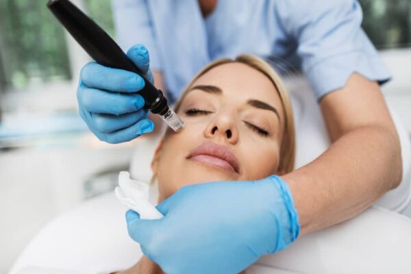 Traditional Microneedling Vs Radiofrequency Microneedling Somasou