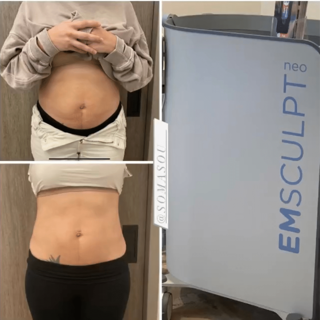 Before and After Image: Body Transformation Journeys