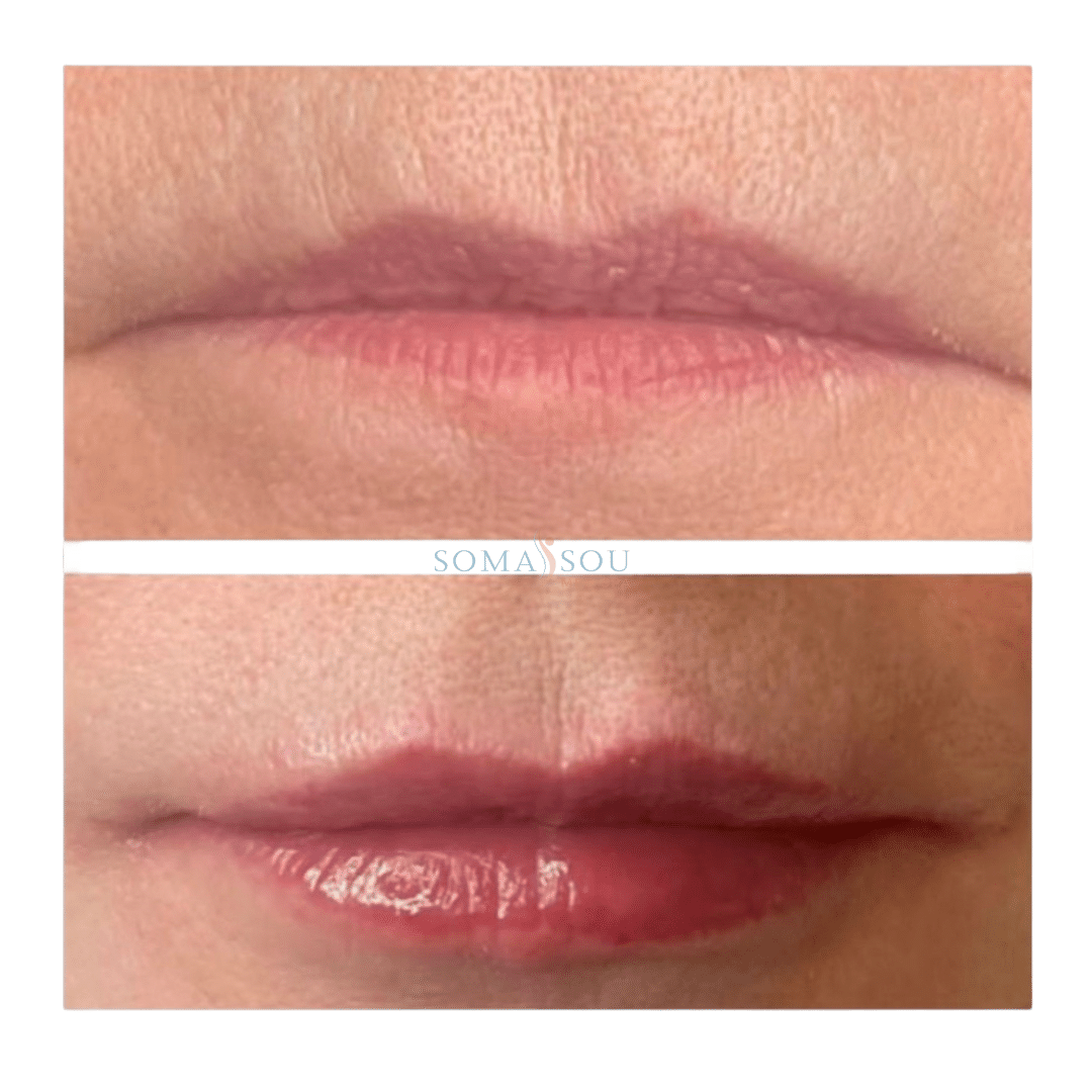 Before and After Image: Lips You’ll Love - front