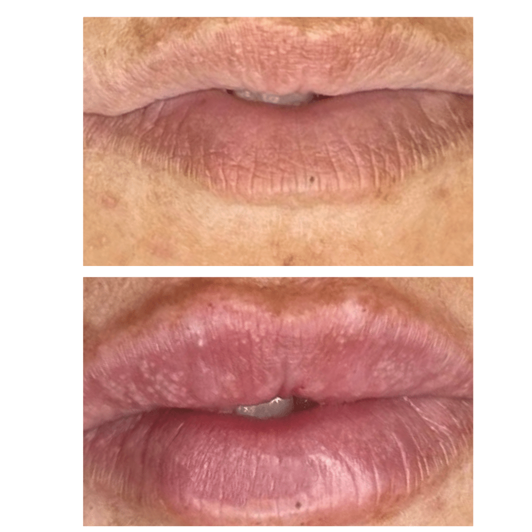 Before and After Image: Lips You’ll Love - front