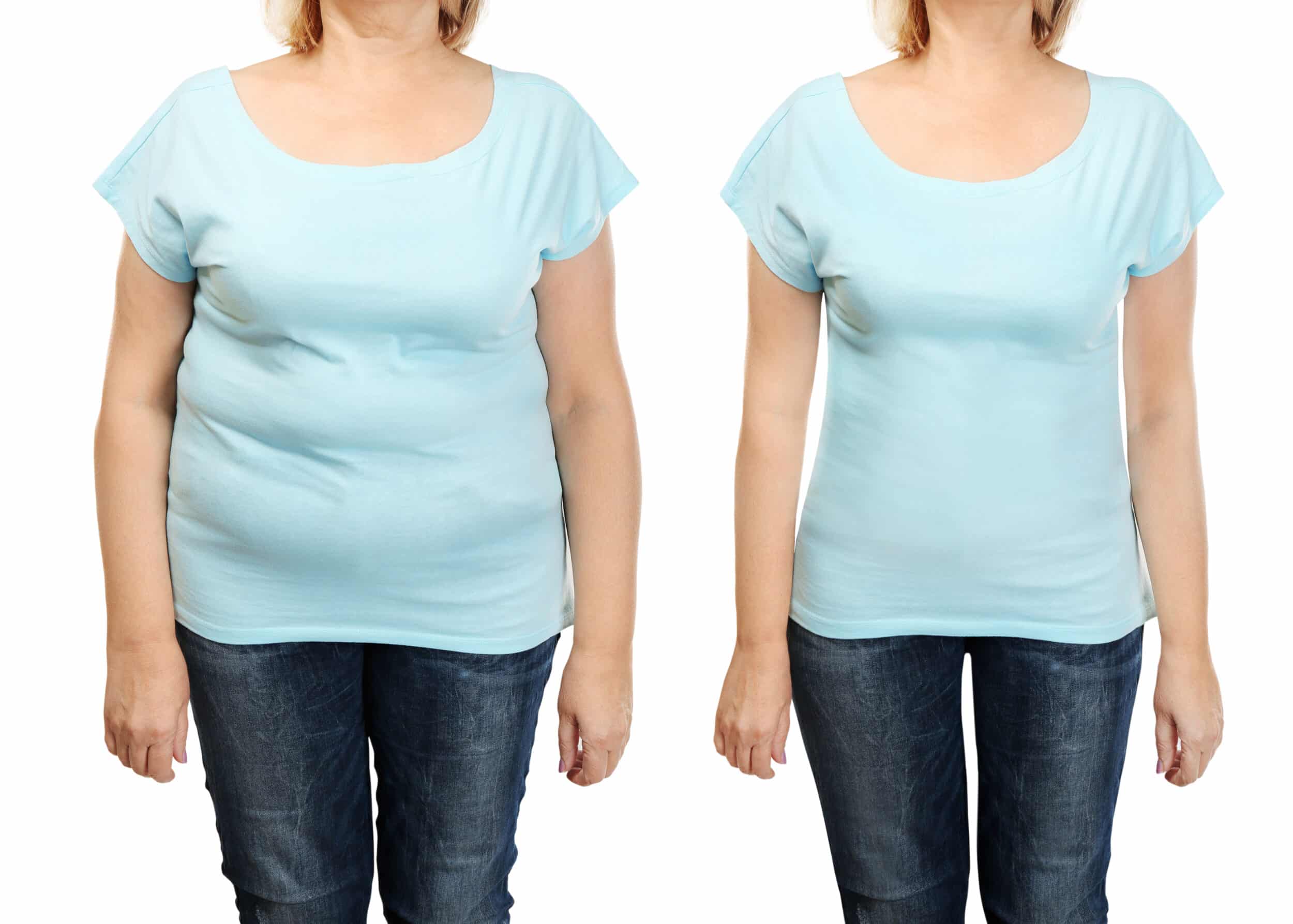 Before and After Image: WeightLoss - front